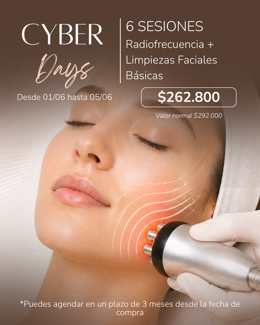 Cyber Days: 6 Sesiones Radiofrecuencia + Limpiezas Faciales Básicas
