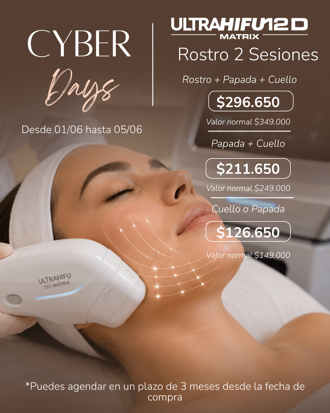 Cyber Days: UltraHifu 12D Rostro
