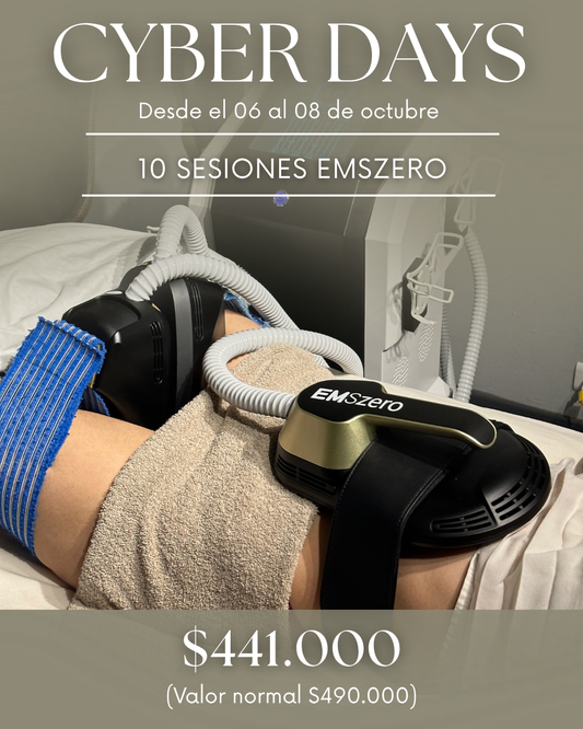 Cyber Days: 10 Sesiones EMSzero