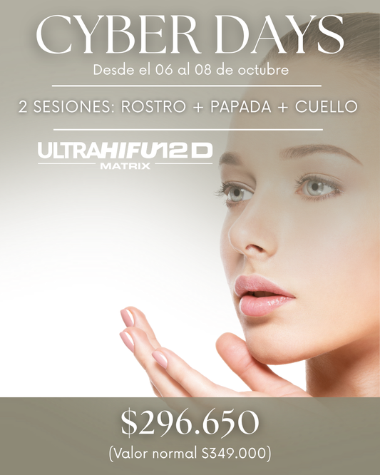 Cyber Days: Ultrahifu 12D – 2 Sesiones (Rostro + Papada + Cuello)